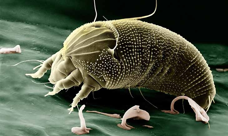 8 de julio: Día Mundial de la Alergia