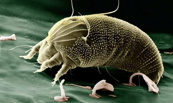 8 de julio: Día Mundial de la Alergia