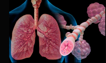 5 de mayo: Día Mundial del Asma